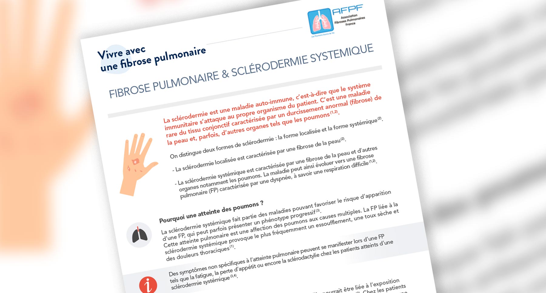 Fiche Pratique Patient : Comprendre la PID-ScS