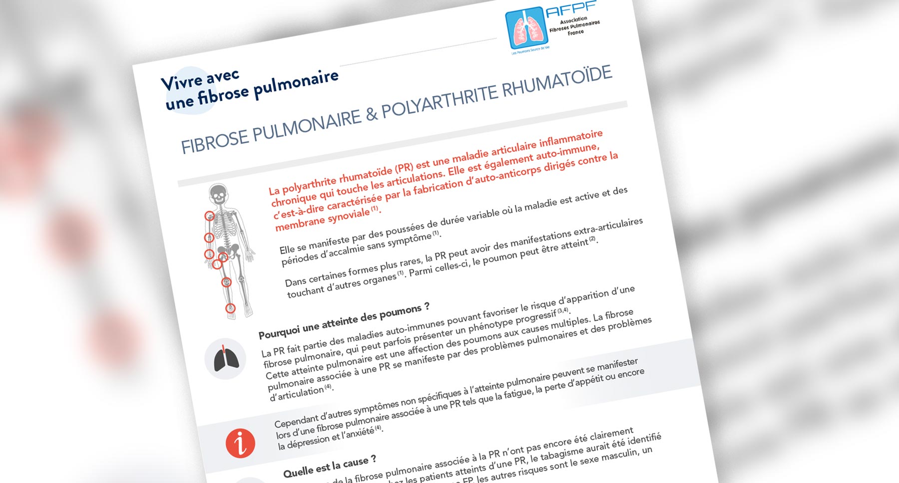 Fiche Pratique Patient: Comprendre la PID-PR