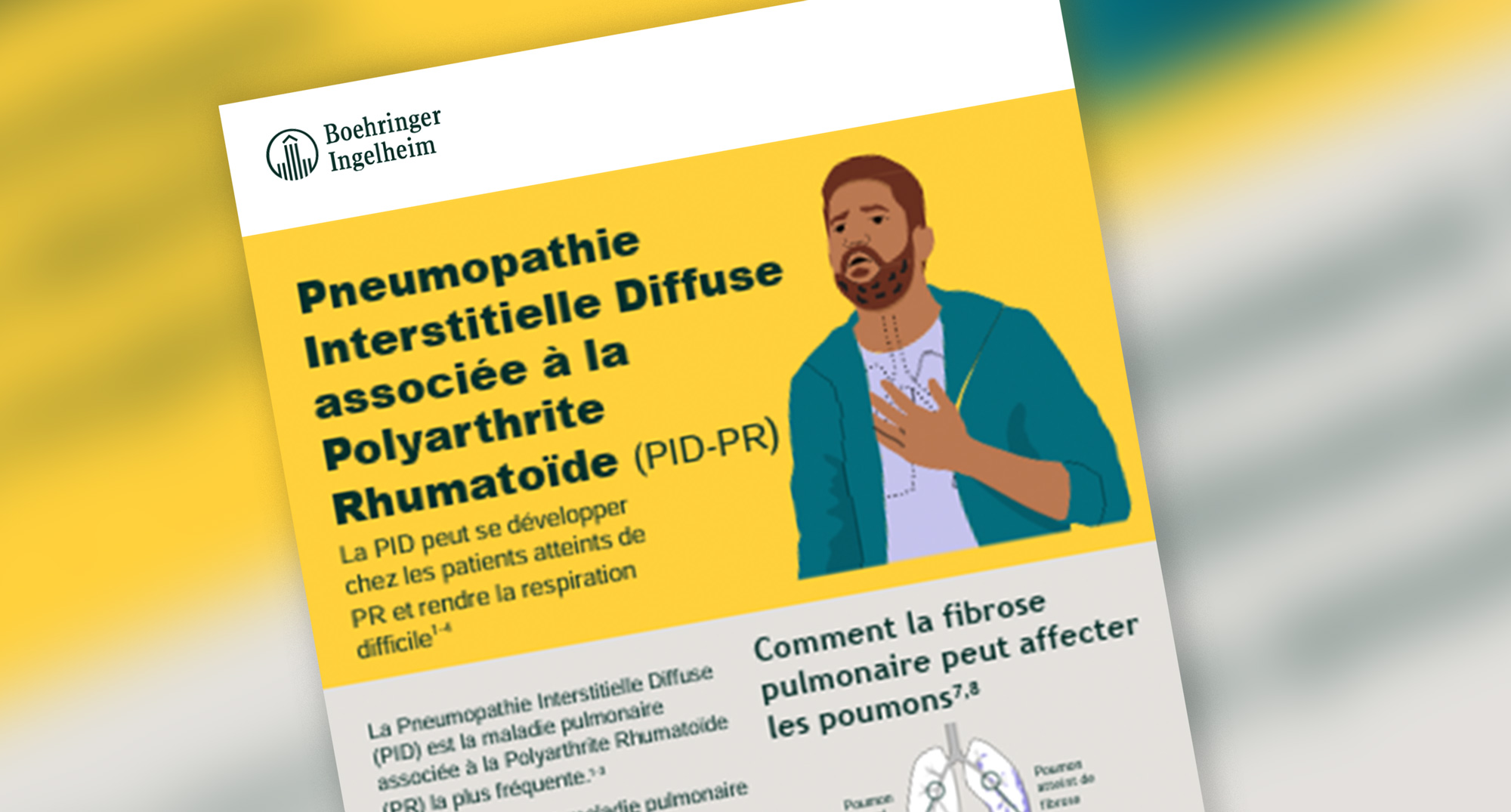 Comprendre et Surveiller la PID liée à la Polyarthrite Rhumatoïde