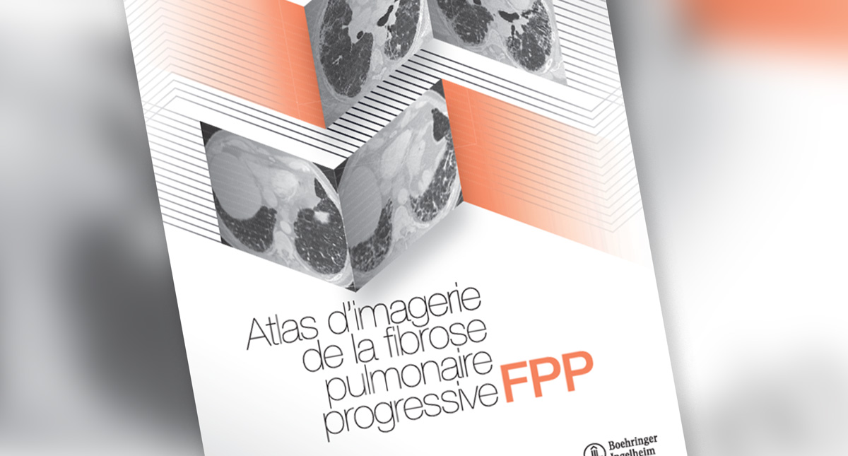 Atlas d'imagerie de la FPP