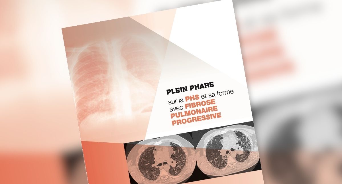 Comprendre et Surveiller la PHS et sa forme avec PID fibrosante progressive