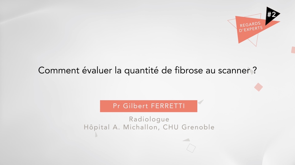 Mieux comprendre comment évaluer la quantité de fibrose au scanner avec le Pr Ferretti