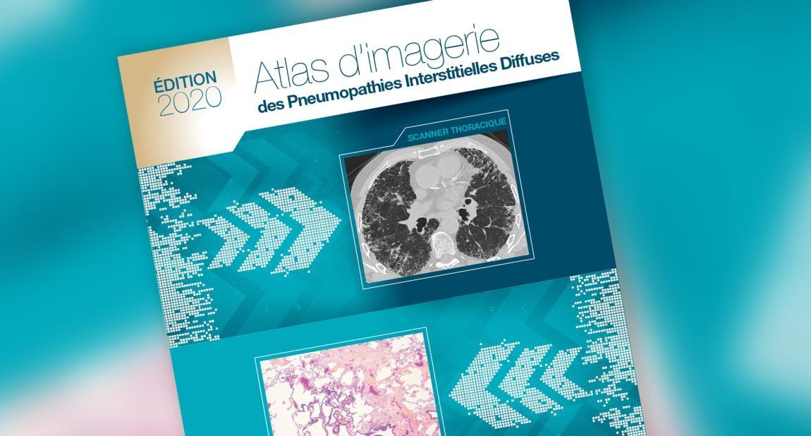 Atlas d'imagerie des Pneumopathies interstitielles Diffuses